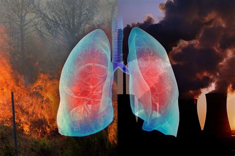 American Lung Association Report Shows 40 Of Us Regularly Breathes