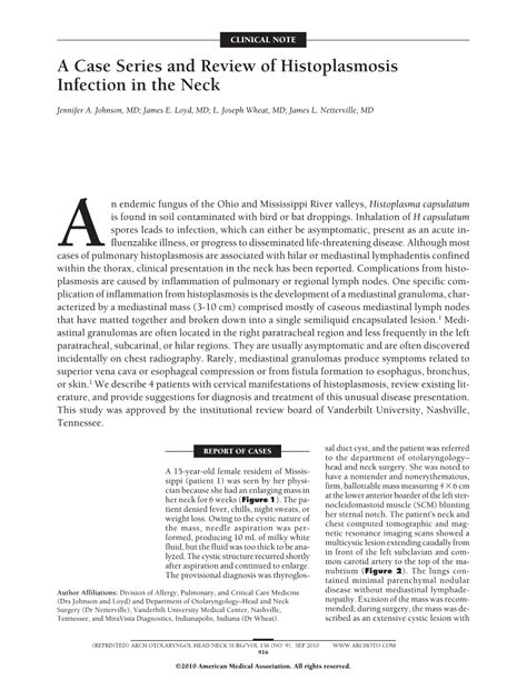 A Case Series And Review Of Histoplasmosis Infection In The Neck