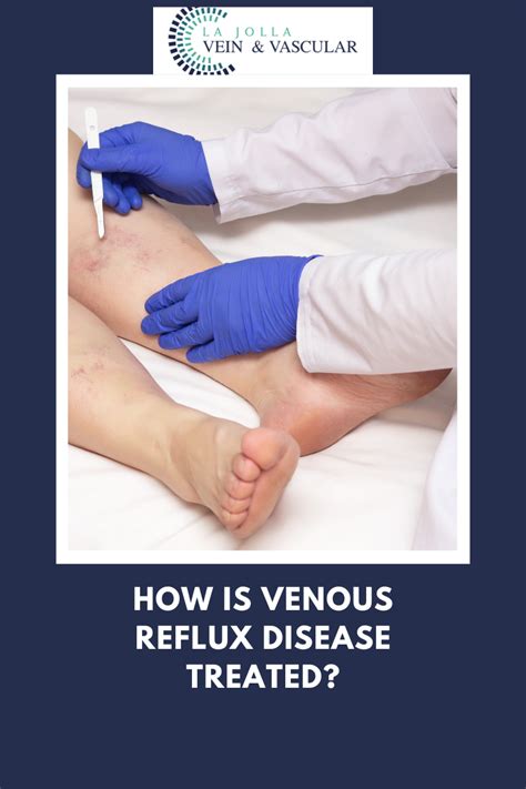 Vein And Vascular Treatment Venous Reflux Disease Treated