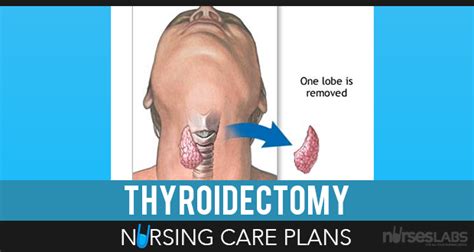 5 Thyroidectomy Nursing Care Plans Nursing Care Plan Thyroidectomy