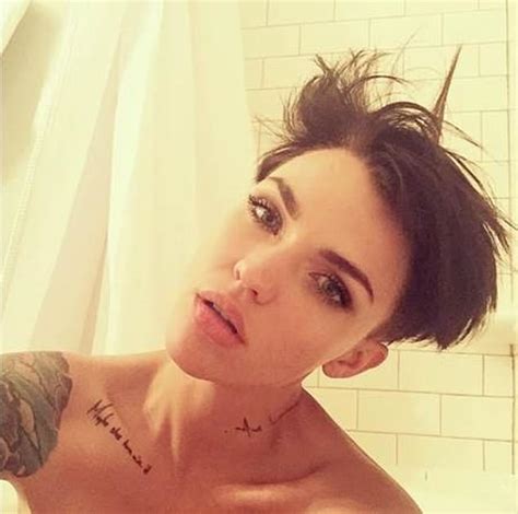 Ruby Rose Shows Off Her Severe Burn After Spending The Day Outdoors