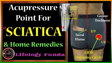 Sciatica Acupressure Point And Home Remedy साइटिका एक्यूप्रेशर