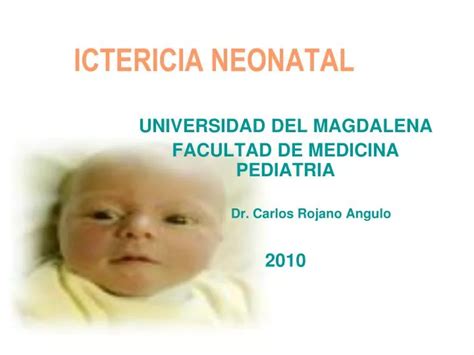 Ppt Hiperbilirrubinemia Ictericia Neonatal Powerpoint Presentation My