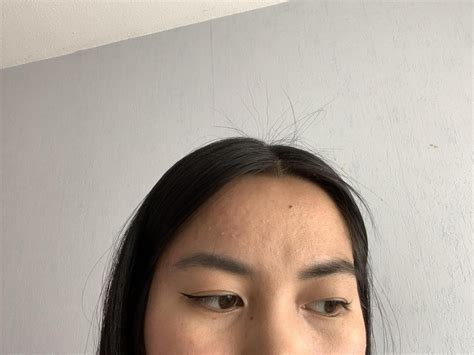 [Routine Help] How to get rid of (or make less worse) forehead