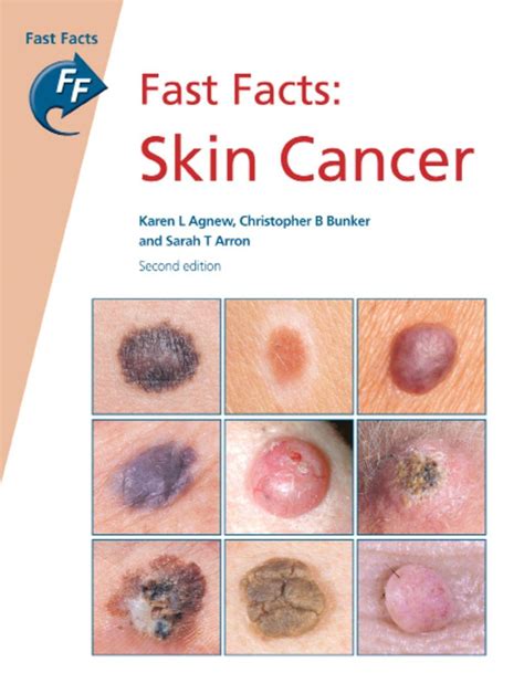Revealing The Truth About Skin Cancer Causes Risk Factors And Symptoms