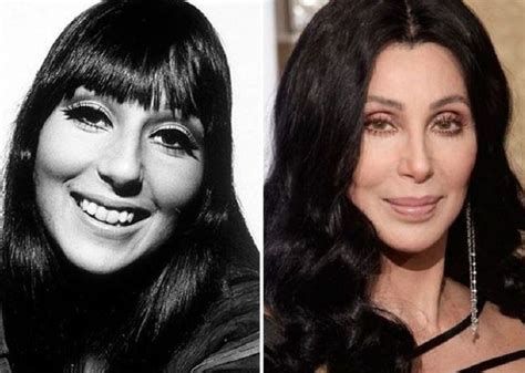 Cher Before Plastic Surgery Celebrity Plastic Surgery Vrogue Co