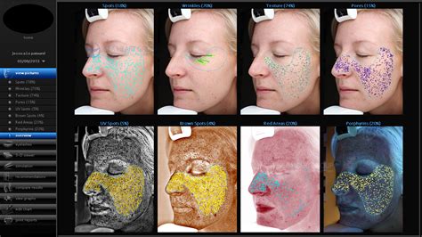 1193142332 apreciado aprendiz, de acuerdo con los contenidos vistos en la inducción y el reconocimiento que hasta el monto ha adquirido. VISIA - CR Skin Analysis Facial Imaging System for ...