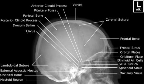 Skull Radiographic Anatomy Wikiradiography
