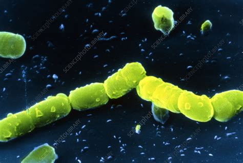 Pseudomonas Aeruginosa Bacteria Stock Image B2200128 Science