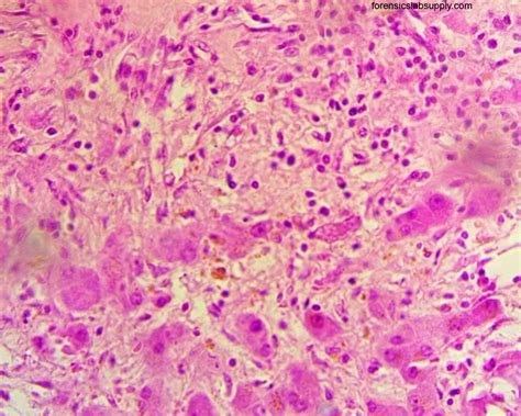 Upon viewing the bacteria under the microscope, you will be able to identify the bacteria based on a wide variety of physical characteristics. La syphilis est de retour aux Etats-Unis - Centre ...