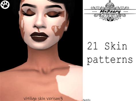 The Sims Resource Vitiligo V3 By Msbeary Sims 4 Downloads