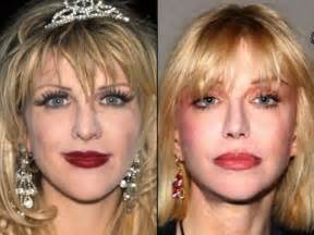 Celebrities Before And After A Plastic Surgery