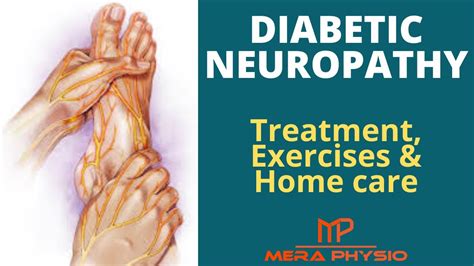 Diabetic Neuropathy Treatment Exercises Home Care For Diabetic