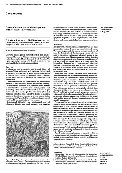 Pdf Onset Of Ulcerative Colitis In A Patient With Colonic Schistosomiasis