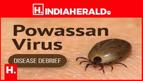 Next Risk Deadly Powassan Virus