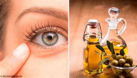 6 Natural Remedies For Eye Inflammation Step To Health