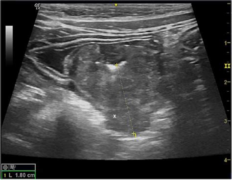 A Case Of Gastric Leiomyosarcoma In A Domestic Shorthair Cat