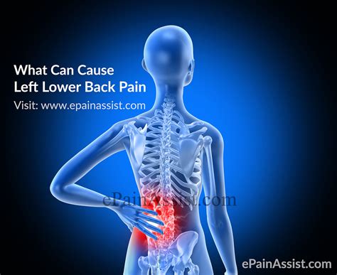 What Can Cause Left Lower Back Painsymptomstreatment