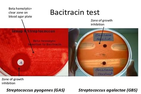Bacitracin Test Principle Procedure Result With Limitation