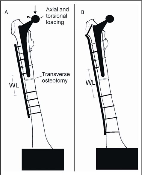 Figure 1 From Biomechanical Comparison Of 2 Different Locking Plate