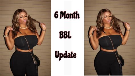 6 Month Bbl Post Op Qanda W Pics The Biggest Transformation Ever Youtube