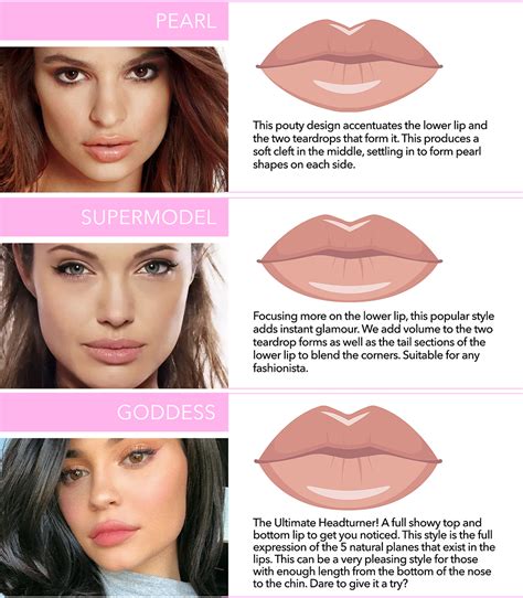 Lip Shapes In Lip Fillers Lip Shapes Lip Fillers Hot Sex Picture