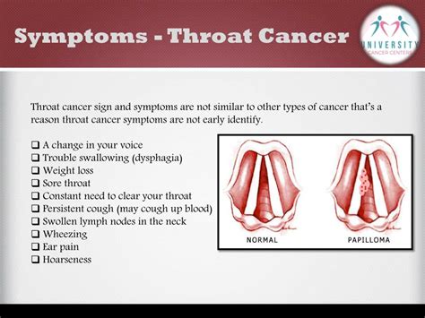 Ppt What Is Throat Cancer And Its Awareness University Cancer