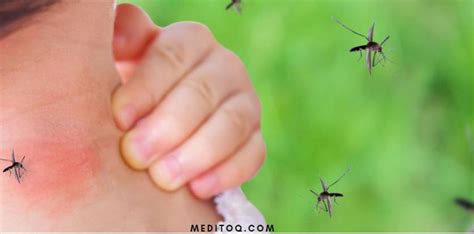 How To Get Rid Of Mosquito Bite Scars Meditoq