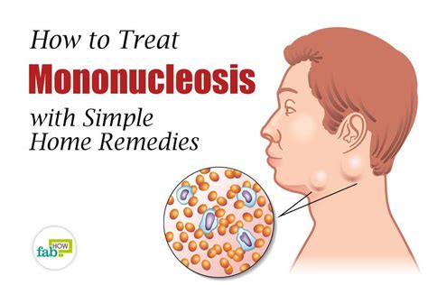 Natural Treatment For Mononucleosis Coconut Oil And Garlic