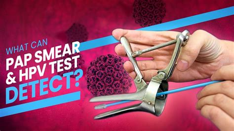 Pap Smear Pap Test And Hpv Test A Step By Step Guide 3d At What Happens During The Test
