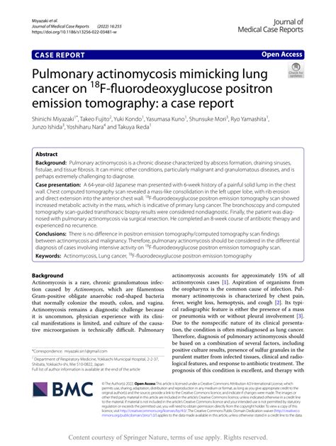 Pdf Pulmonary Actinomycosis Mimicking Lung Cancer On F