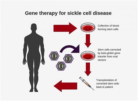 Researchers Create New Viral Vector For Improved Gene Therapy In Sickle