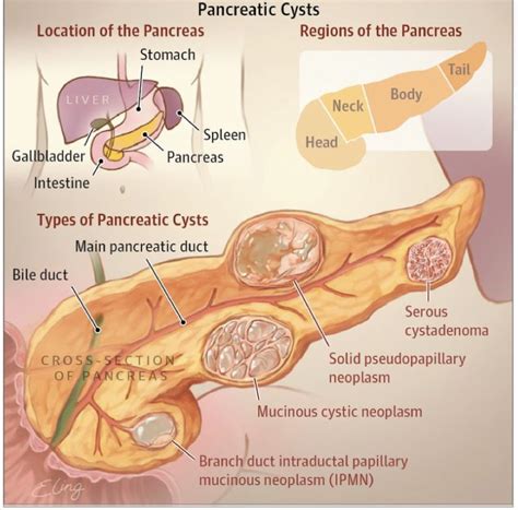 What Is The Pancreas And What Does It Do Lifespan Io My XXX Hot Girl
