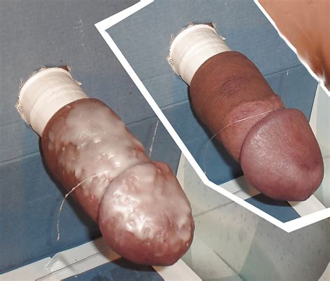 More Old Pictures Of Penis Torture Pics XHamster
