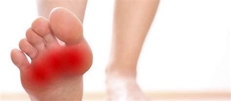 Intermetatarsal Bursitis Ankle Foot And Orthotic Centre