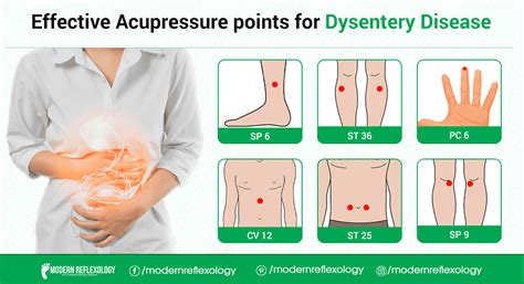 Acupressure Points For Dysentery Problems Modern Reflexology