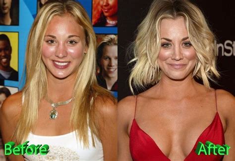 Hair Beauty Kaley Cuoco Plastic Surgery Rumors Are A Direct Consequence Of Her Popularity I
