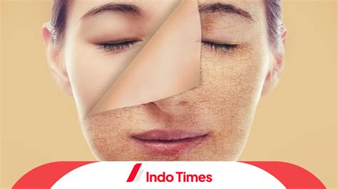 12 Penyebab Kulit Wajah Kering Dan Cara Mengatasinya Indo Times