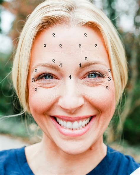25 How Often To Get Botox Forehead Ideas