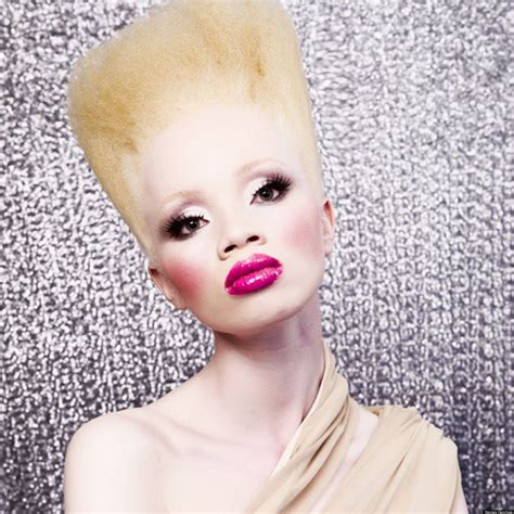 Albino Models Making Their Mark Opening Minds In Africa Huffpost
