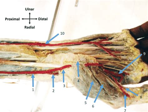 Photograph Showing The Superficial Palmar Branch Of The Radial Artery