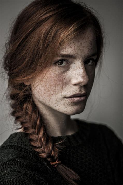 6b99d4a70eaacc930bc282721e7cb718 13332000 Beautiful Freckles