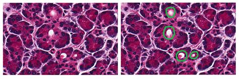 Are The Areas Marked Part Of Pancreatic Acinar Cells Image Analysis