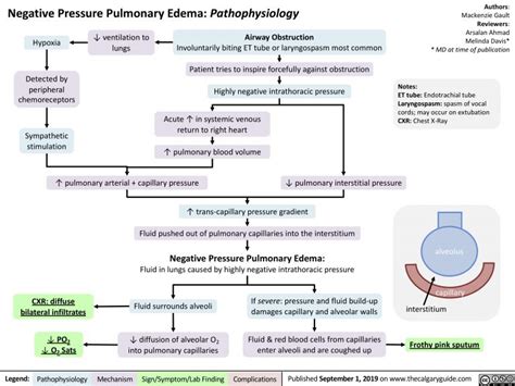 Negative Pressure Pulmonary Edema Pathophysiology Calgary Guide