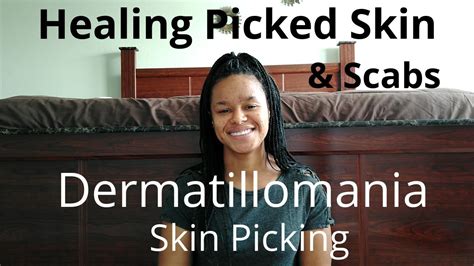 Healing Picked Skin And Scabs Dermatillomania Youtube