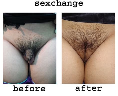 Sex Change Pussy Sex Change Surgery Photos Picture