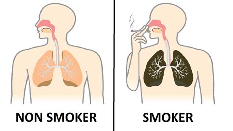 difference between smokers and non smokers diferr