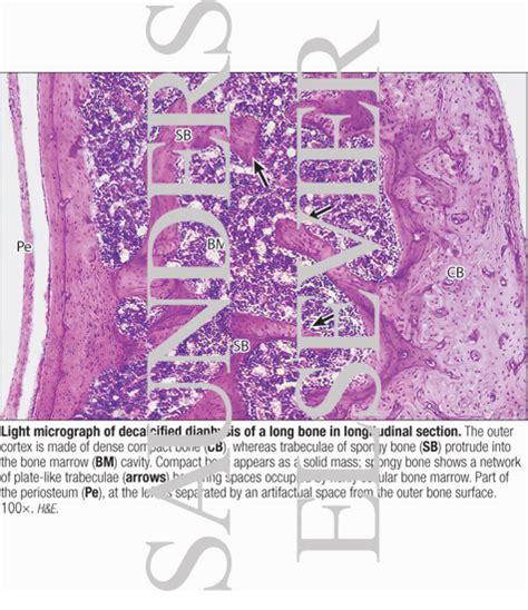 Compact bone, makes up the dense material in a long section of a bone. Light Micrograph of Decalcified Diaphysis of a Long Bone ...