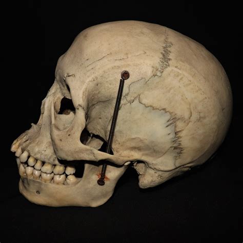 Sold Huge Asian Male Skull Oddarticulations Llc