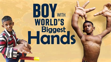 Viral Video This 12 Year Old Boy Has Worlds Biggest Hands Measuring